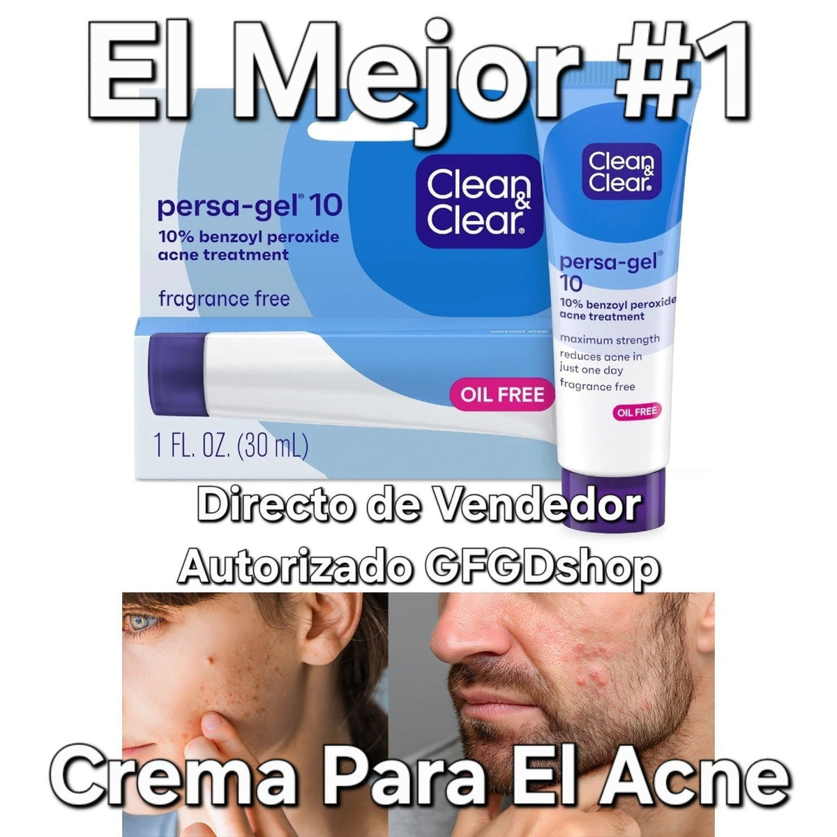 Acne Spot Treatment for Pimples Blackheads and Breakouts - Face & Neck