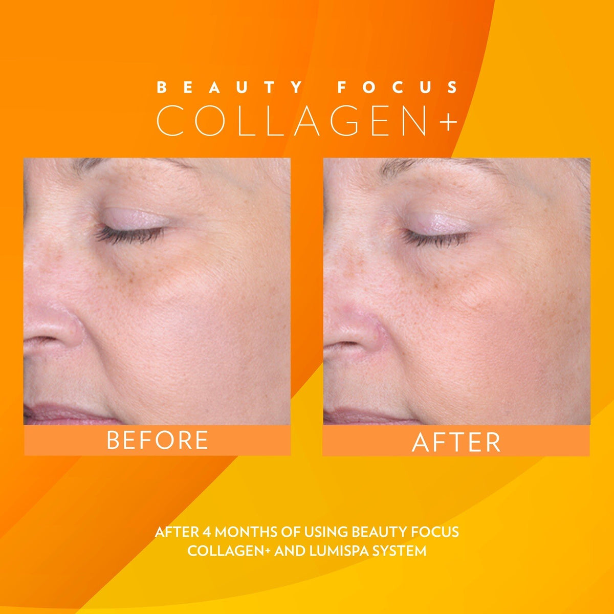 Liquid Collagen Drink for Skin Radiance and Anti-Aging - Peach Flavor, 30 Days Supply