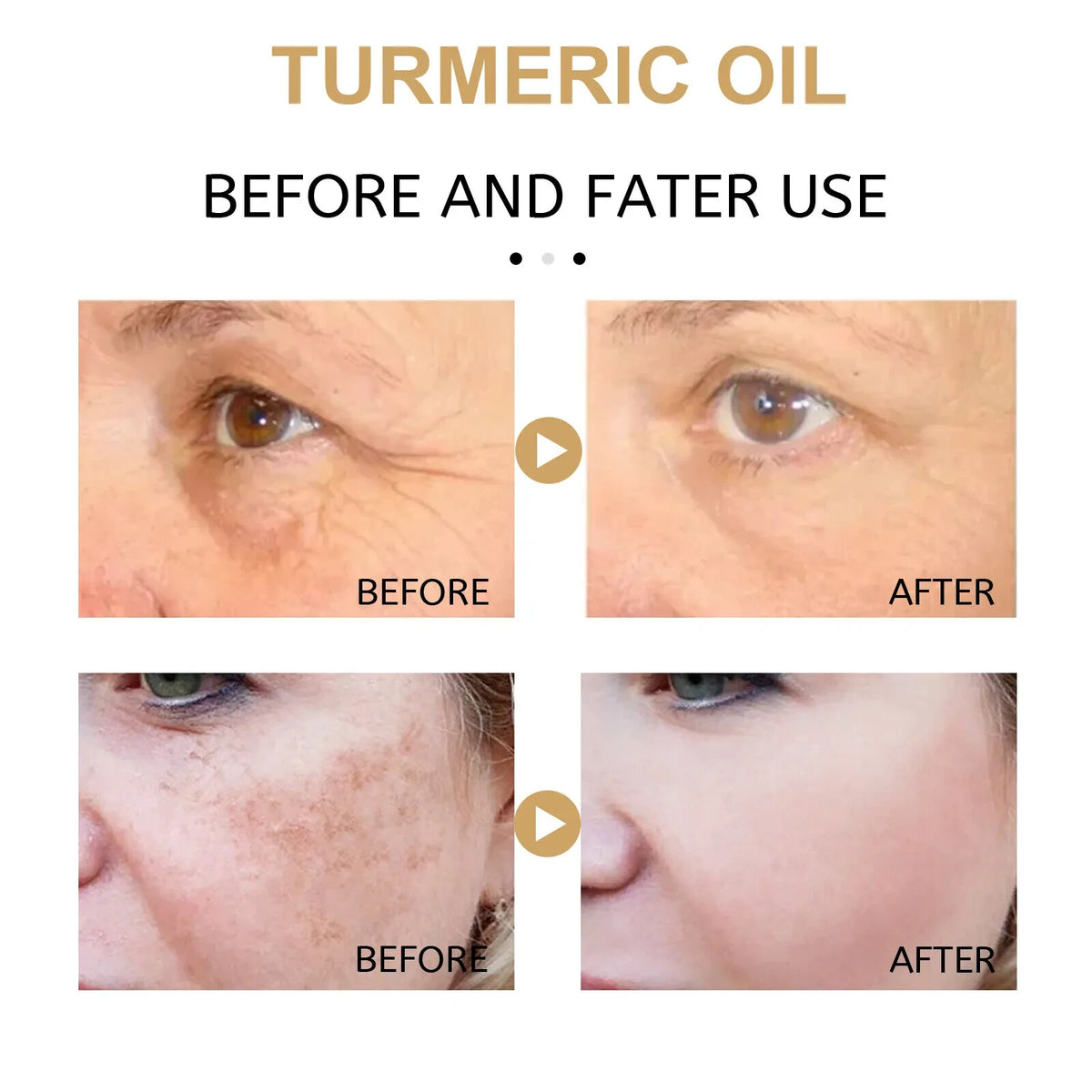 Turmeric Face Serum Oil for Brightening and Acne Blemish Treatment - 1.8 Fl Oz