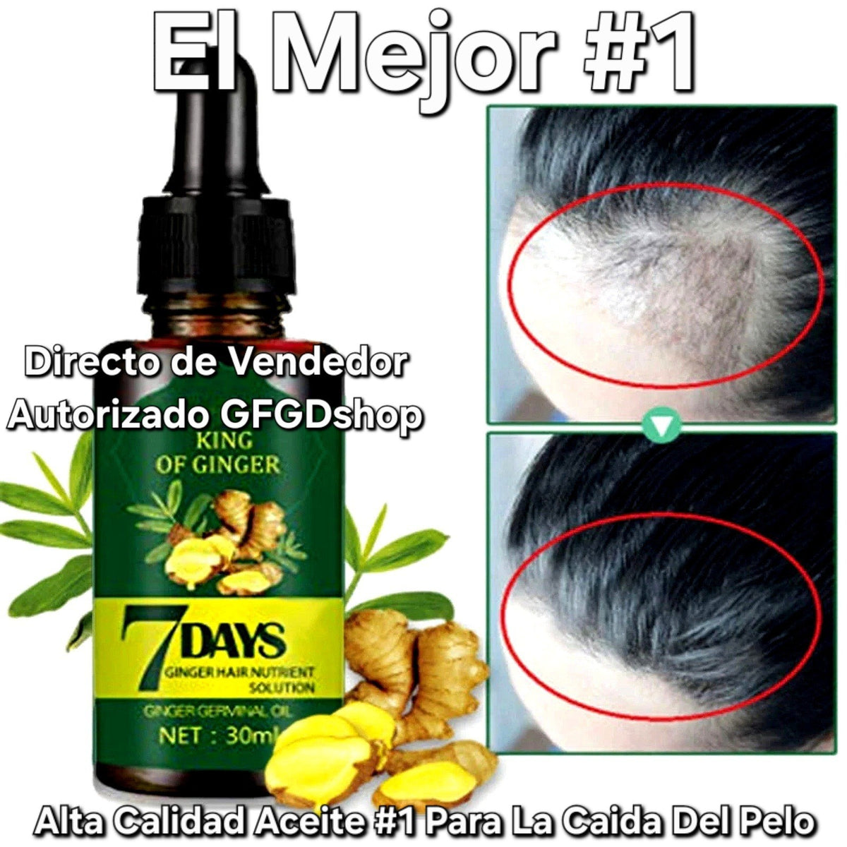 Ginger Hair Growth Oil Treatment - Anti Hair Loss Serum