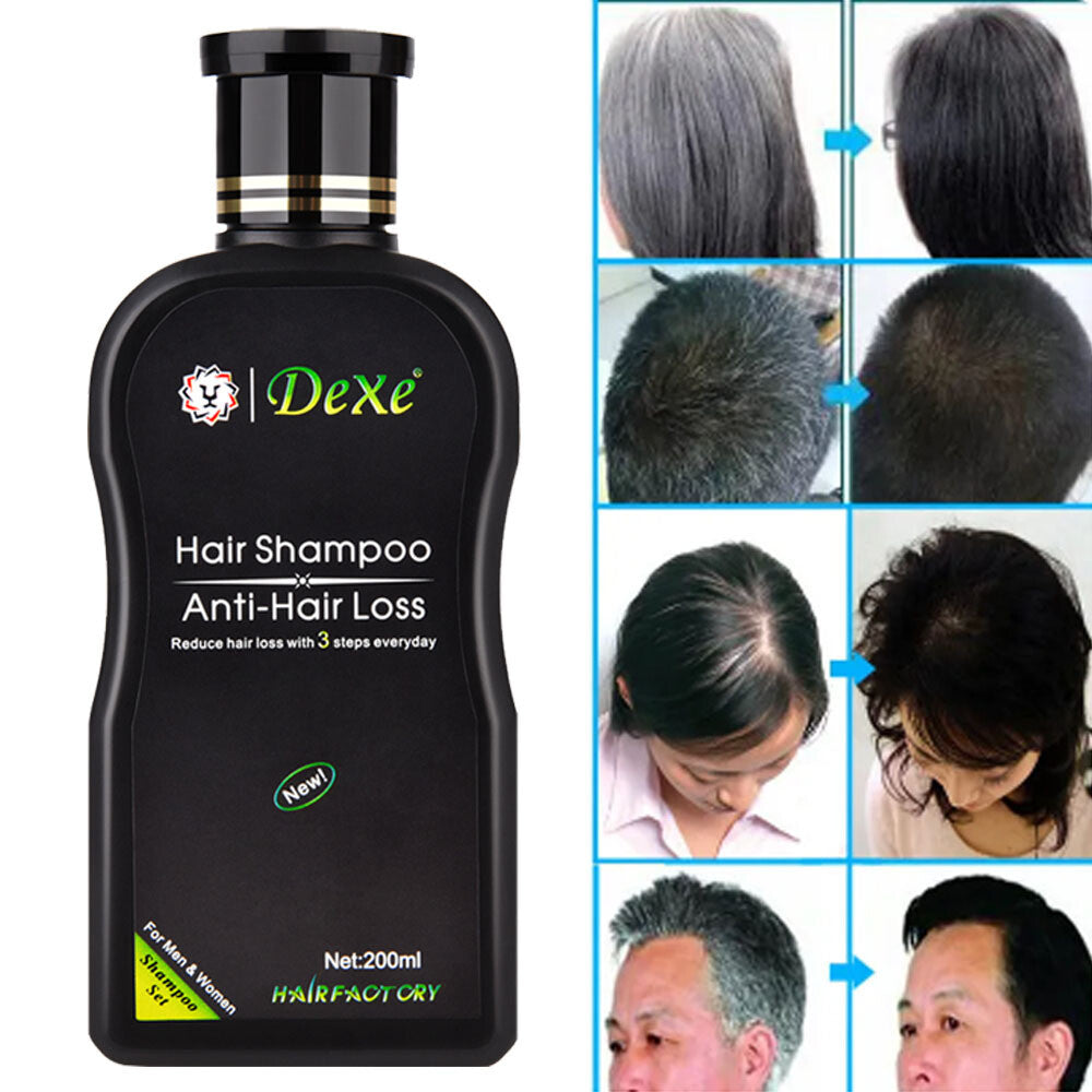 Anti Hair Loss Shampoo - 200ml Herbal Regrowth Treatment