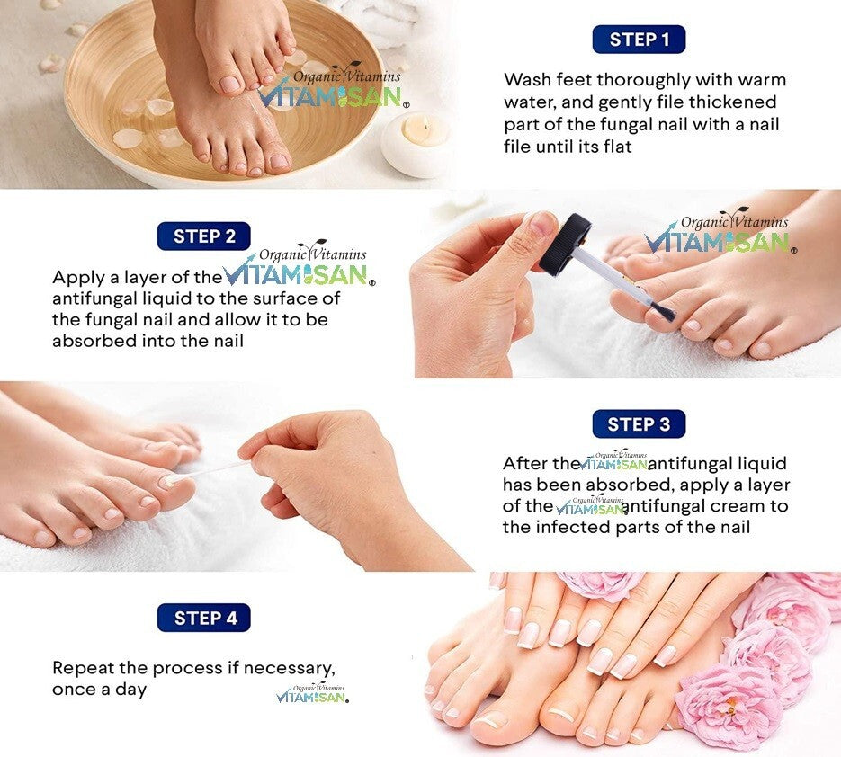 Antifungal Liquid Brush for Toenail Fungus - Max Strength 30ml