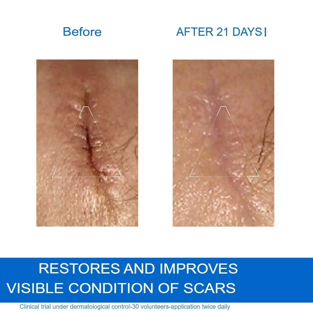 Sensitive Skin Repair Cream for Face and Body - 40ml, Fragrance-Free, Hydrating & Soothing