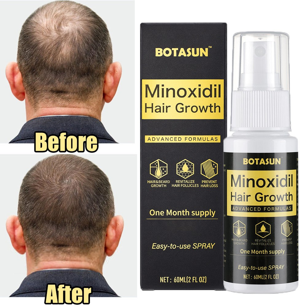 Minoxidil 5% Hair Growth Spray for Men - 60ml
