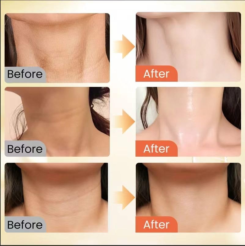 Firming Neck Cream with Roller for Wrinkles & Tightening - 4.2oz