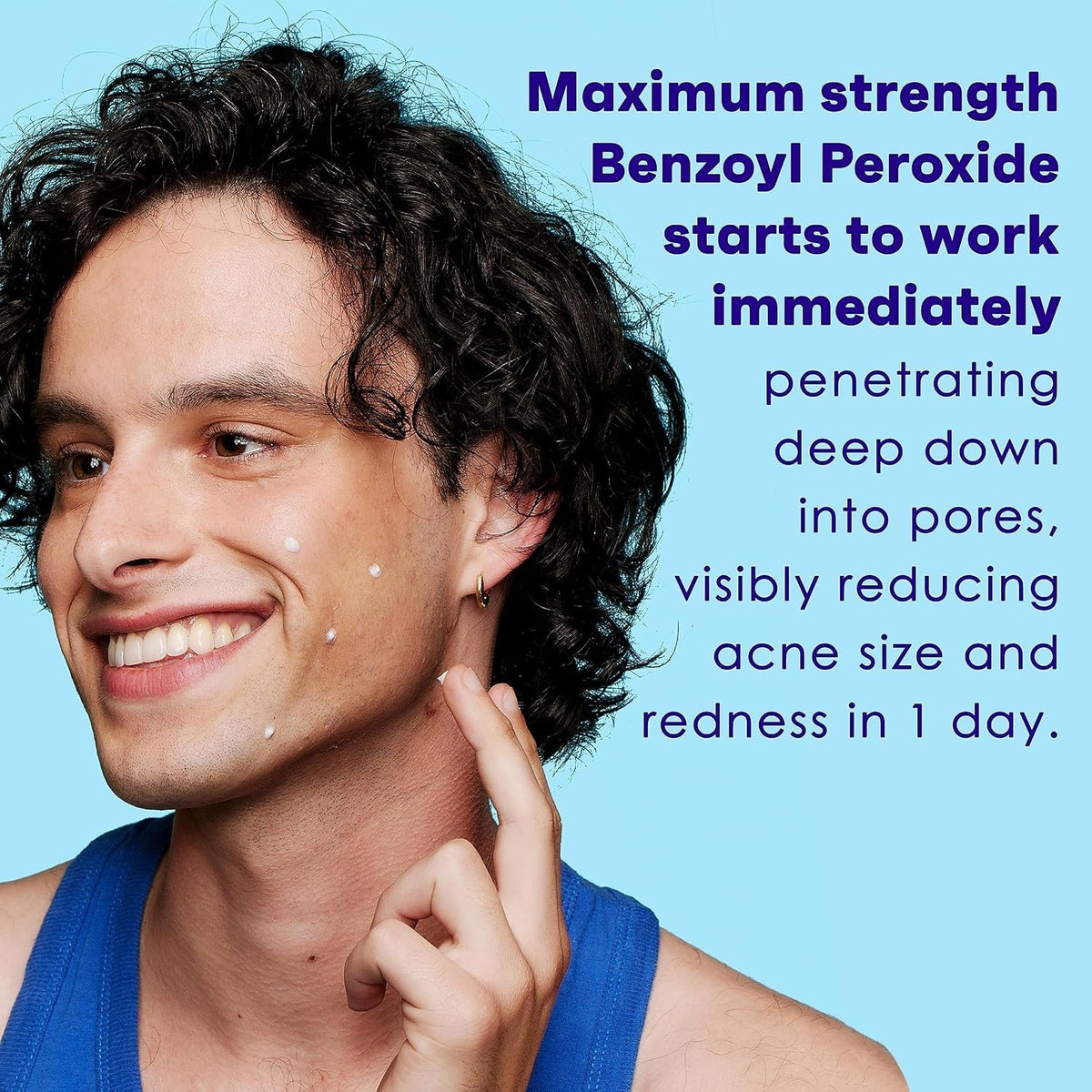 Maximum Strength 10% Benzoyl Peroxide Acne Spot Treatment Gel Fragrance-Free
