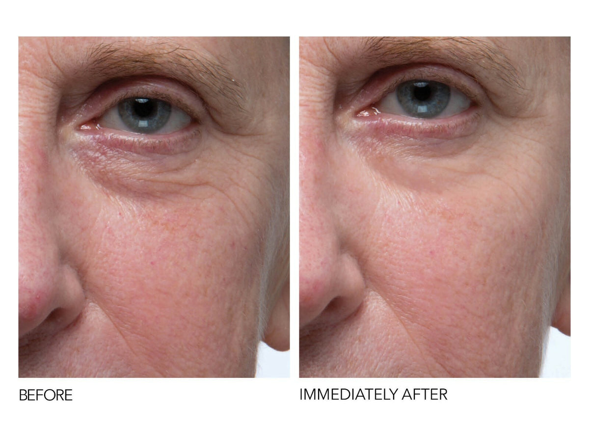 Anti-Aging Face Serum with Matrixyl 3000 & Hyaluronic Acid - 1oz