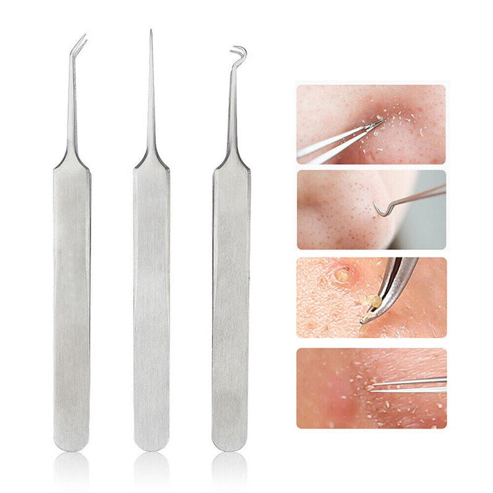 Blackhead Remover Tweezers Set - Pimple Blemish Extraction Tools