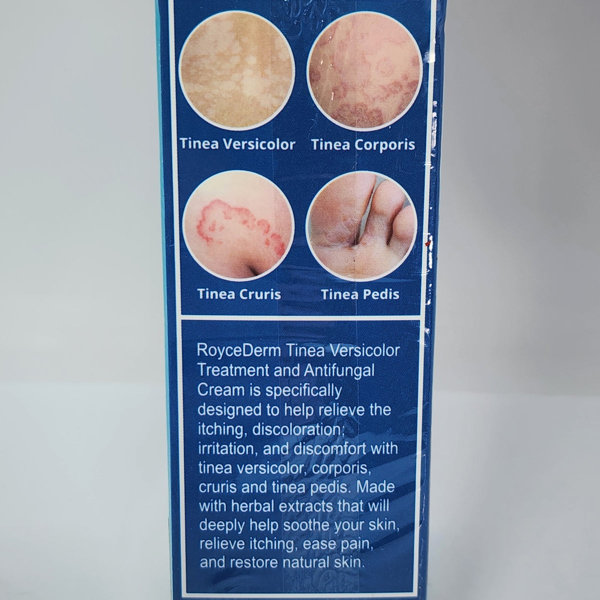 Antifungal Cream for Tinea Versicolor & Pedis 2 oz - Fungal Skin Treatment