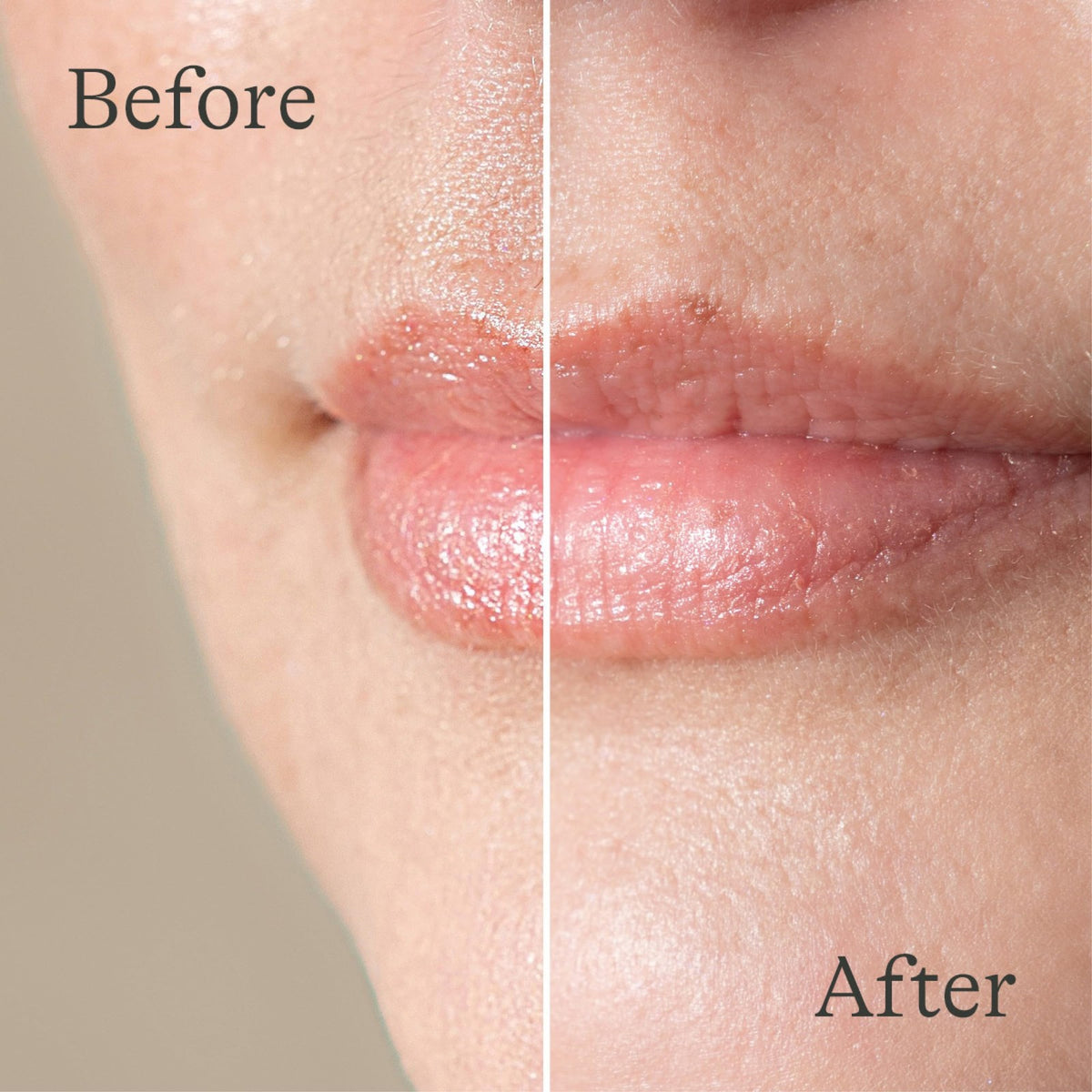 Lanolin Lip Balm Set - 2 Pack, Ultra-Moisturizing Natural Lip Care