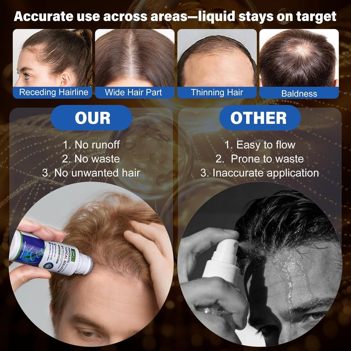 5% Minoxidil Hair Growth Serum for Men & Women - 3 Pack