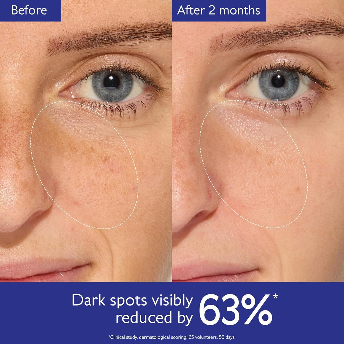 Brightening Face Serum for Dark Spots - Caudalie Vinoperfect 50ml