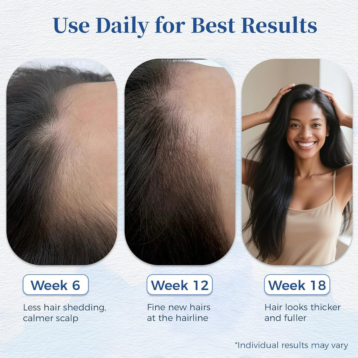 Hair Growth Serum, Biotin, Roll-On, Thinning Treatment, 30ml,