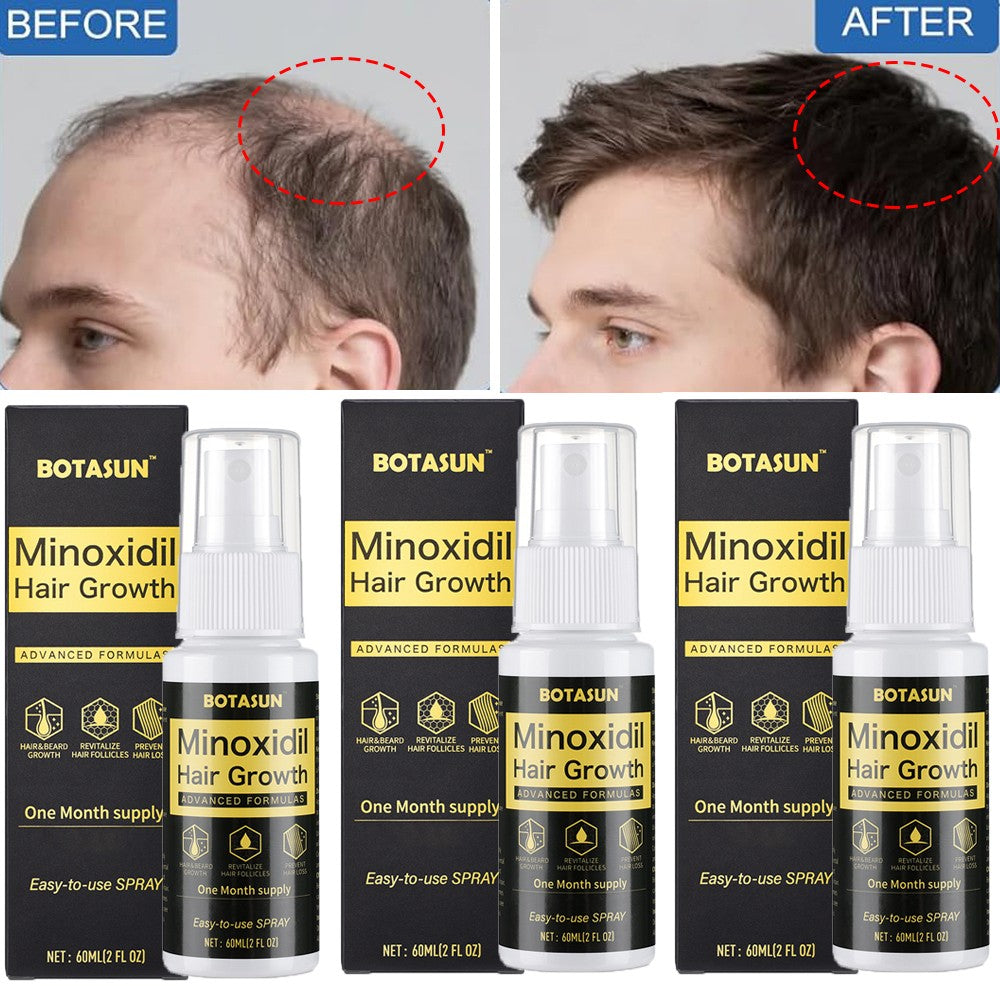 5% Minoxidil Hair Regrowth Spray for Men - 3 Pack