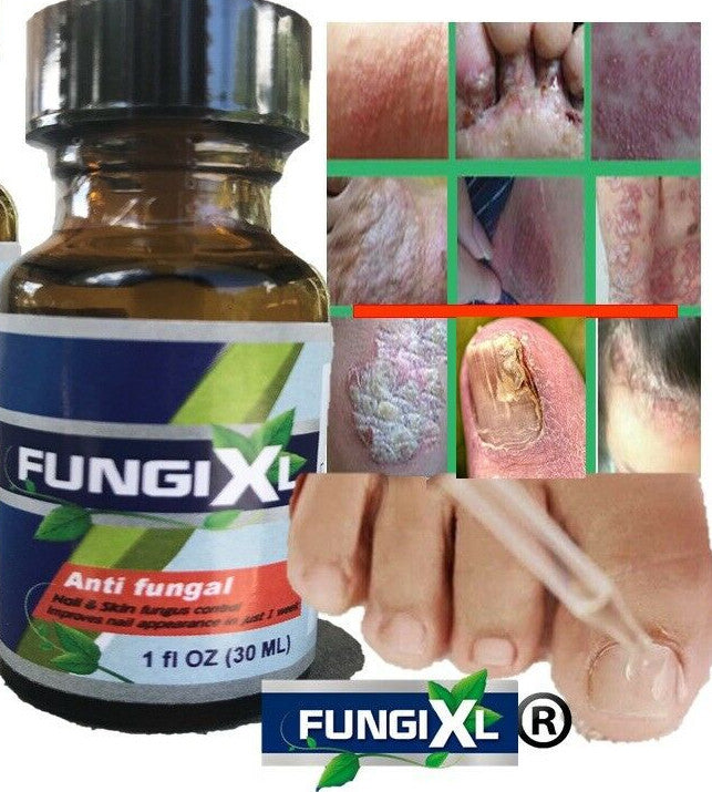 Antifungal Nail Treatment Solution for Toe & Fingernails