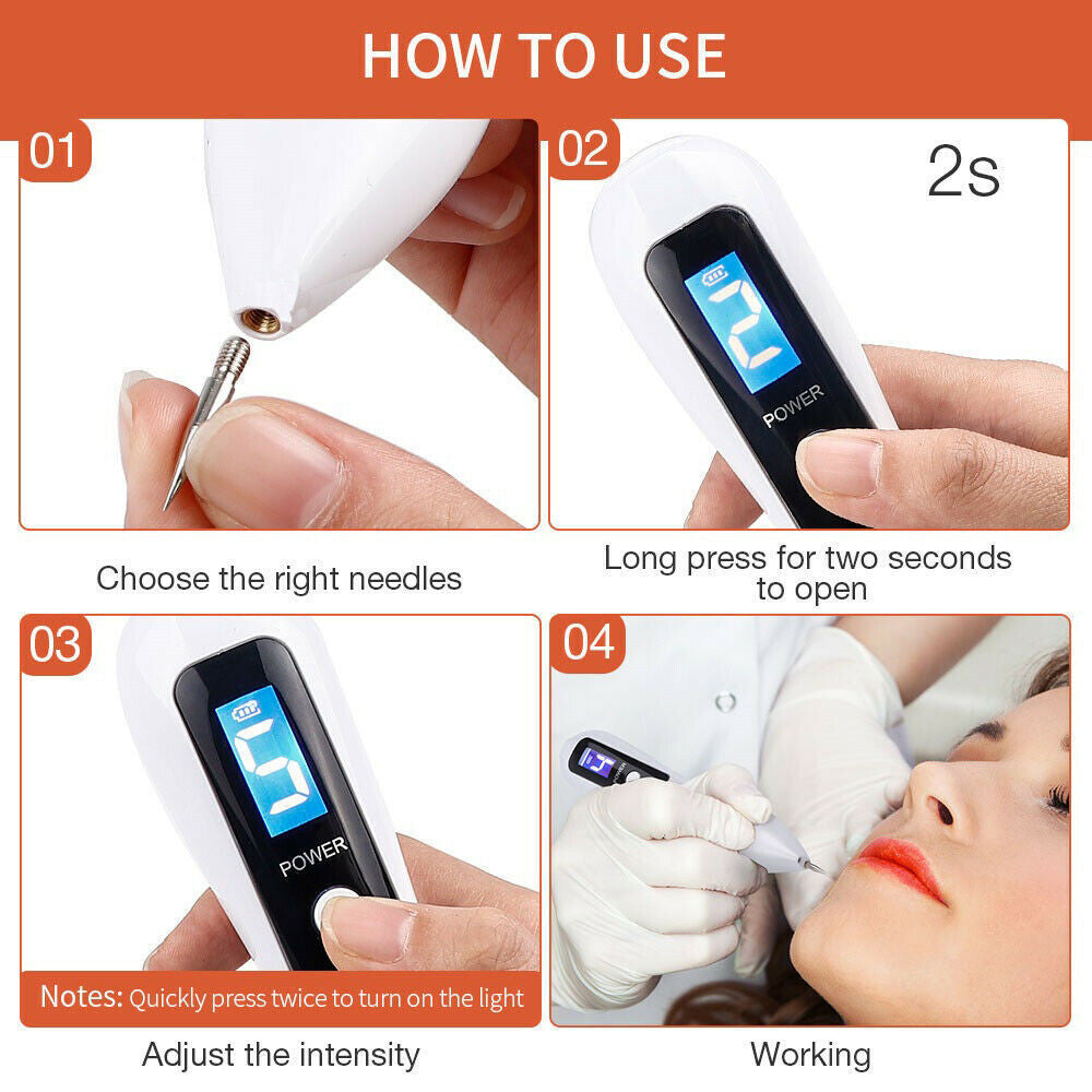 Home Use Laser Mole & Skin Tag Remover Pen - Dark Spot & Tattoo Removal