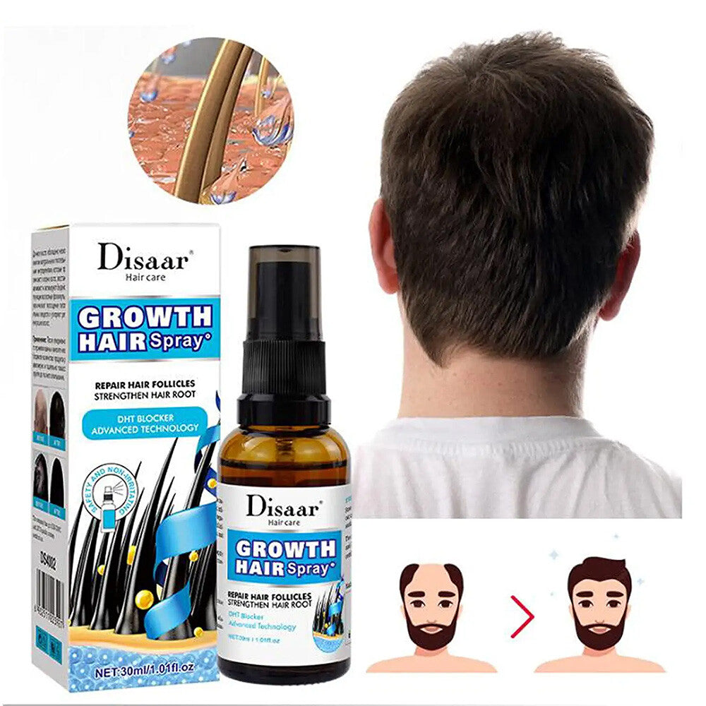 Hair Growth Essence Spray - Ginger & Herbal Formula, 30ml