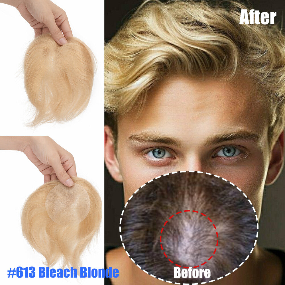 Men's Hair Patch for Bald Spot, Receding Hairline & Hair Loss Cover Up
