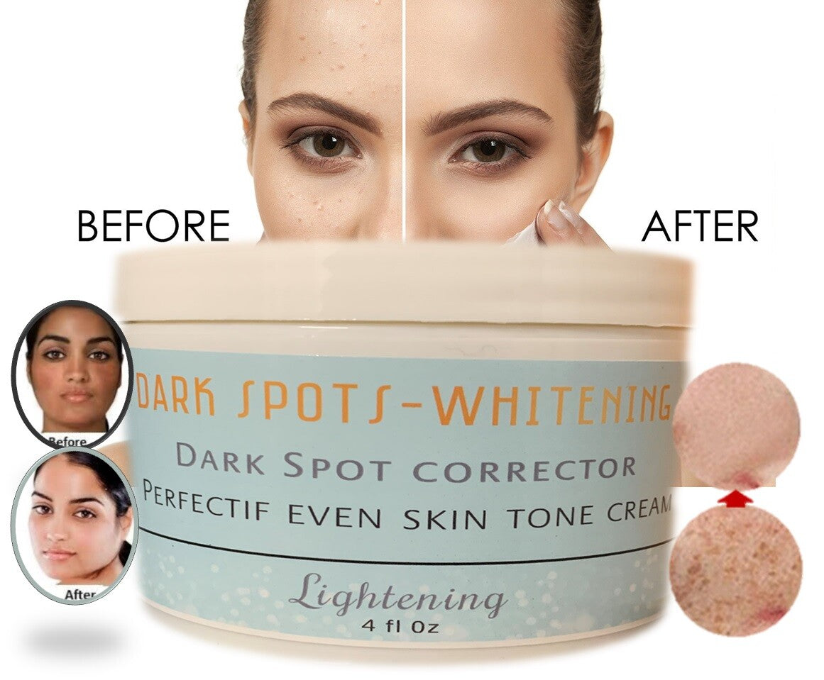 Dark Spot Corrector Cream for Face - Even Tone Skin Support & Brightening