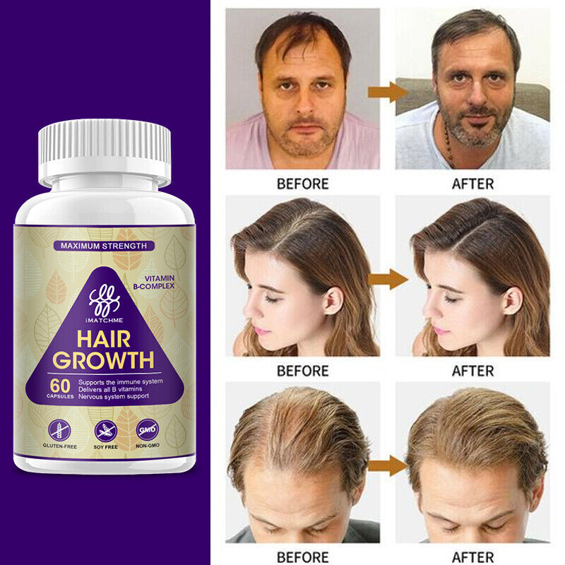 Hair Growth Herbal Supplement Pills 5000mg - Fast Results