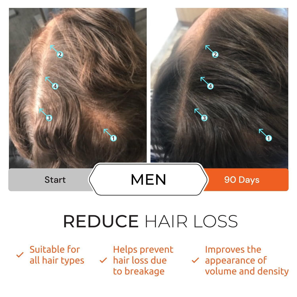 Revita Hair Growth Shampoo 925ml - Stimulates Hair Regrowth & Strengthens Scalp