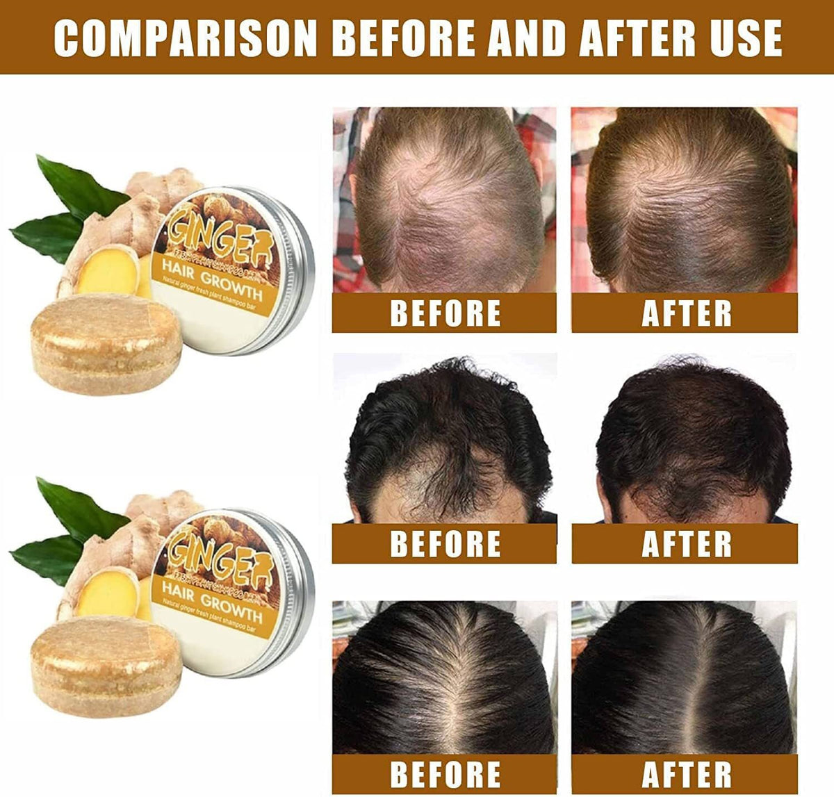 Organic Ginger Hair Regrowth Shampoo Bar - Promotes Hair Growth & Scalp Care (Pack of 1 or 2)