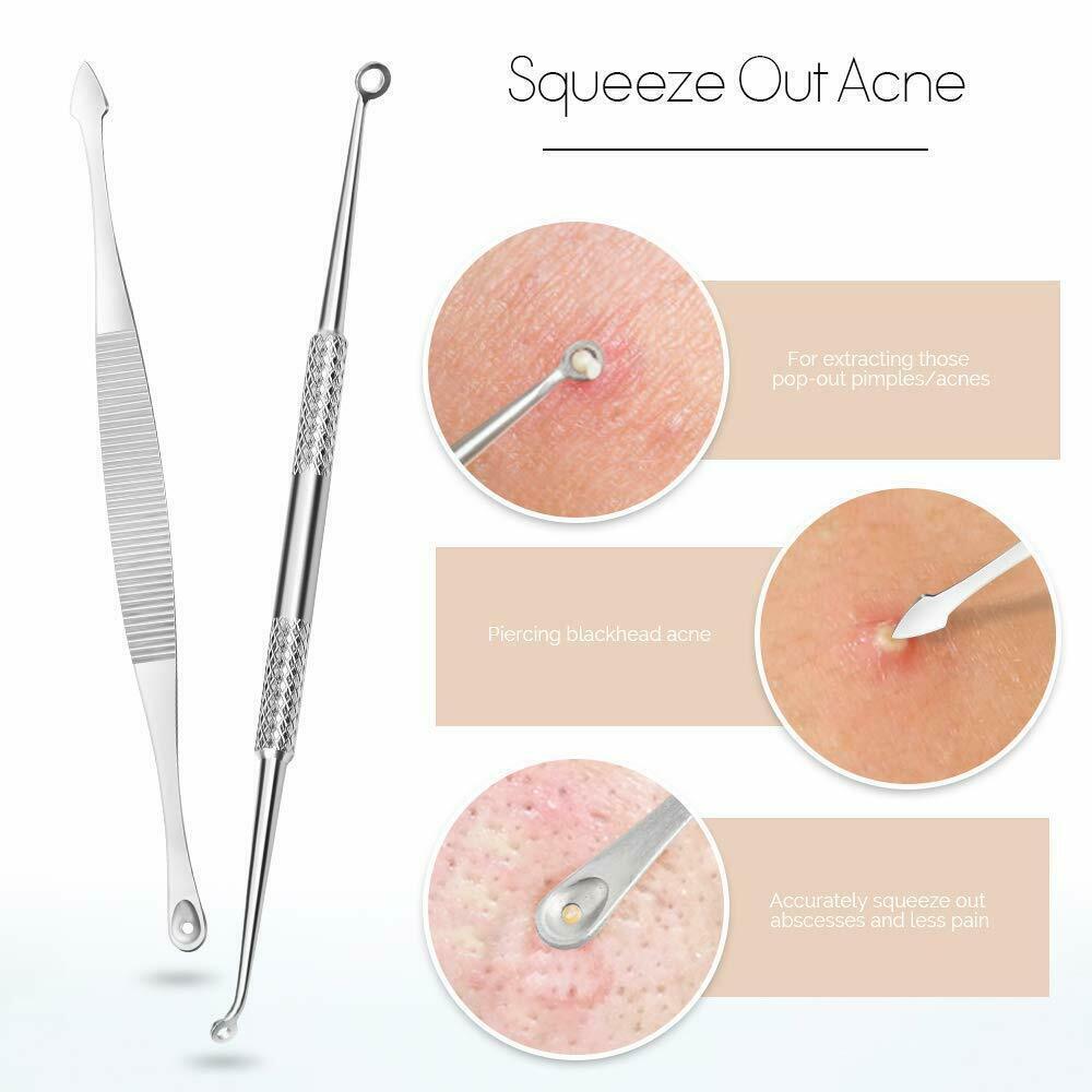 Blackhead Remover Tool Kit - 9 Pcs Pimple Acne Comedone Extractors for Skin Care