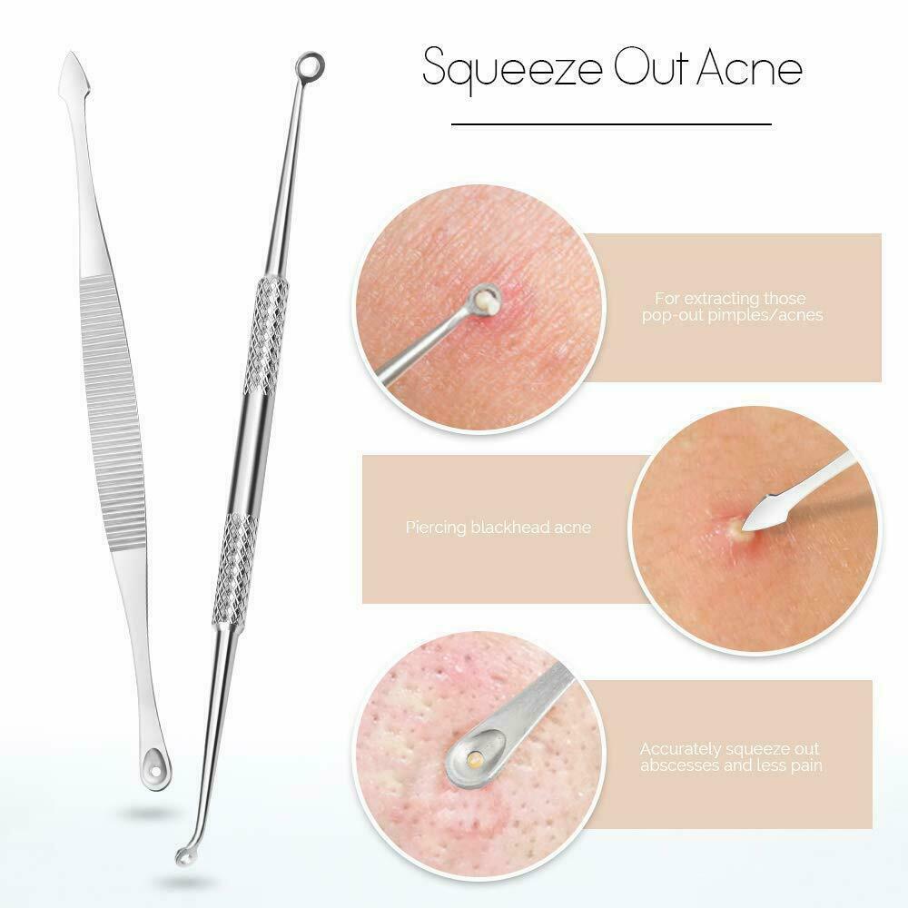 9Pcs Blackhead Acne Pimple Extractor Kit with Travel Case - Professional Skin Care Tools
