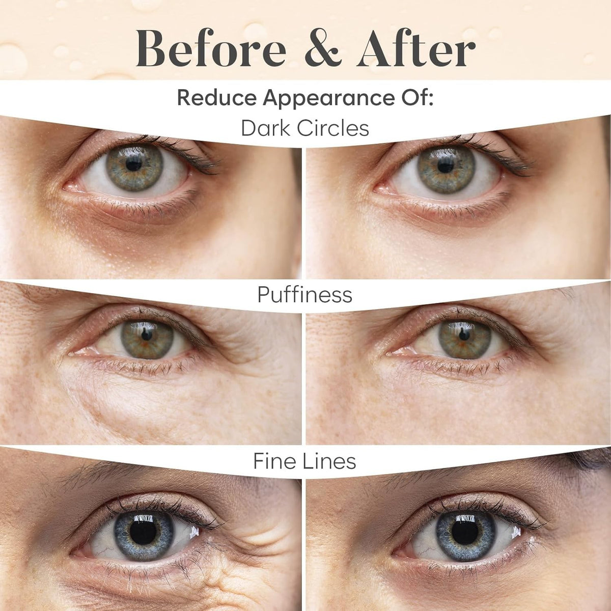 Variety Pack Under Eye Masks for Dark Circles & Puffiness - 30 Pairs