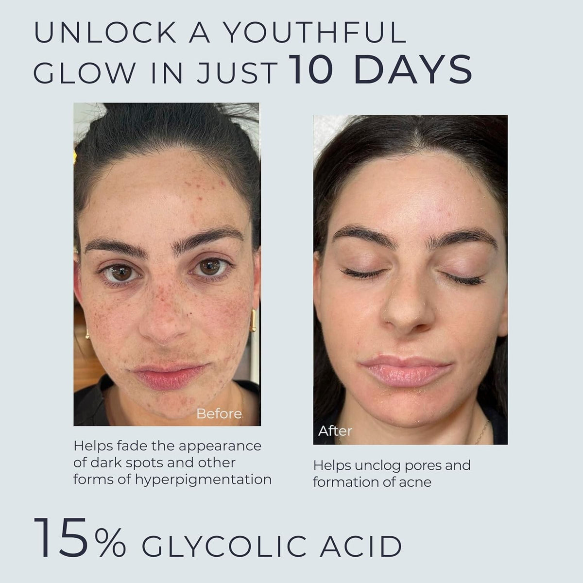 Glycolic Acid 15% Lactic AHA Face Serum for Brightening & Anti-Aging 2oz