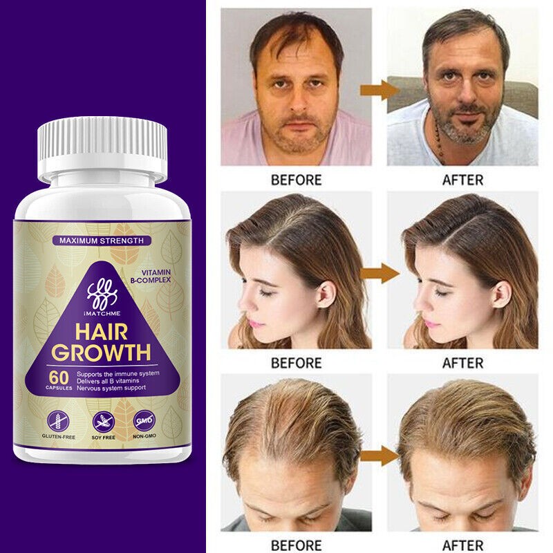 Hair Growth Formula Supplement Pills+Vitamins+Biotin ALL B Vitamins