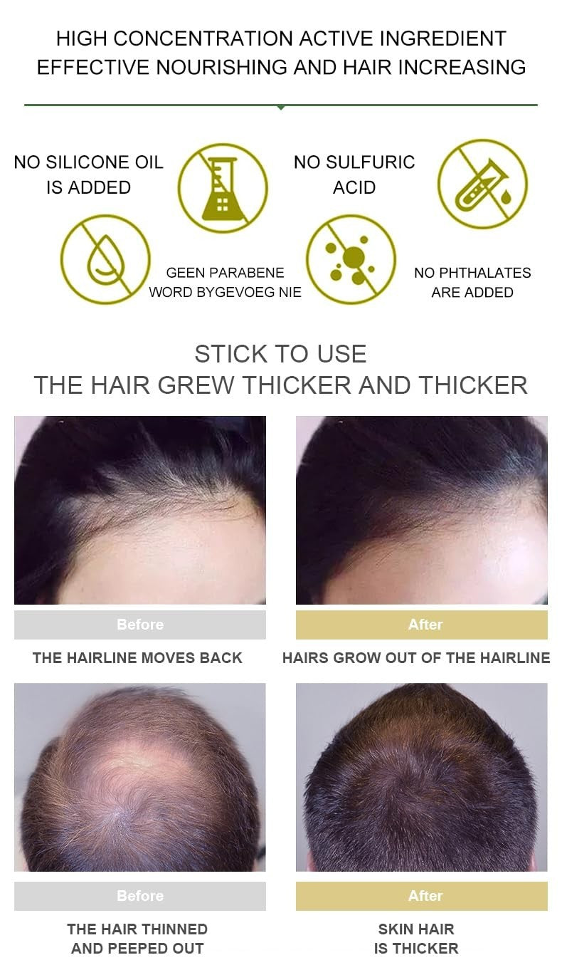 Ginger Hair Growth Oil Treatment - Anti Hair Loss Serum