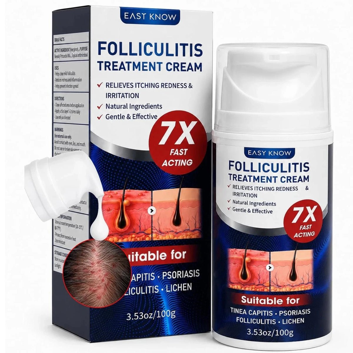 Folliculitis Treatment Cream with Benzoyl Peroxide & Tea Tree Oil - 100g