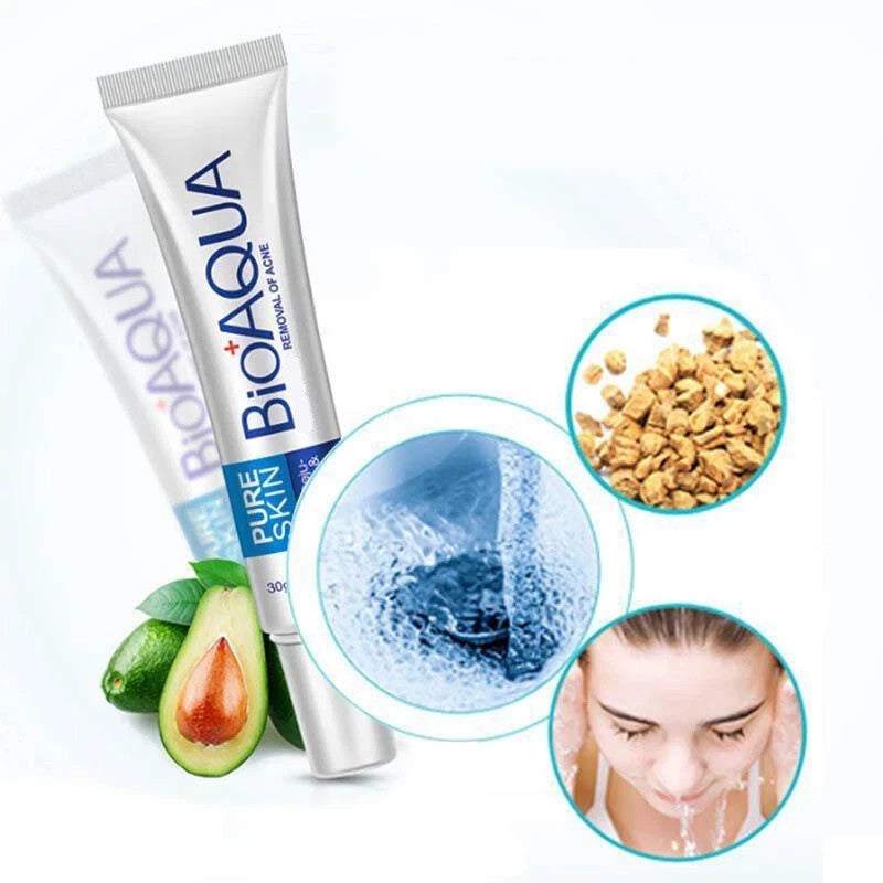 Acne Treatment Cream for Blemishes & Spots - 30ml Face Skin Care