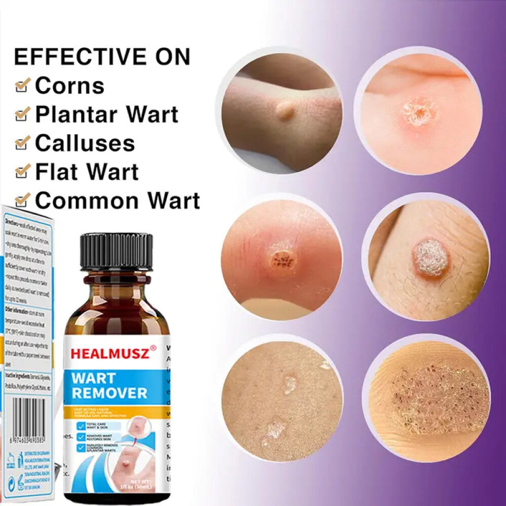 Wart Remover Liquid for Plantar & Body Warts - Fast Acting Herbal Formula