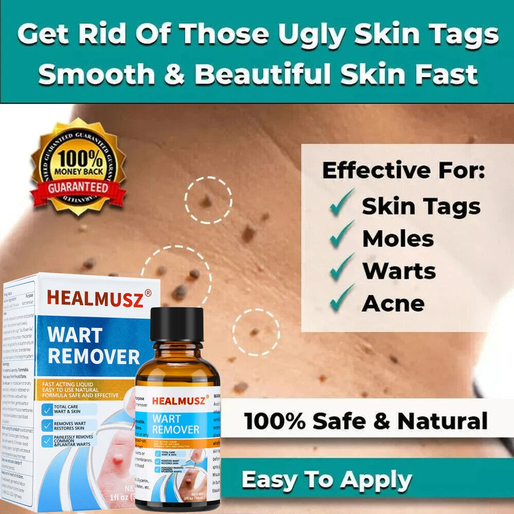 Natural Wart & Skin Tag Remover Liquid - Deep Penetration Formula, 30ml