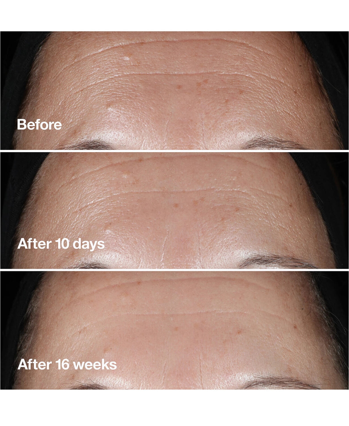 Clinique Smart Clinical Repair Wrinkle Correcting Serum - Anti-Aging Face Treatment