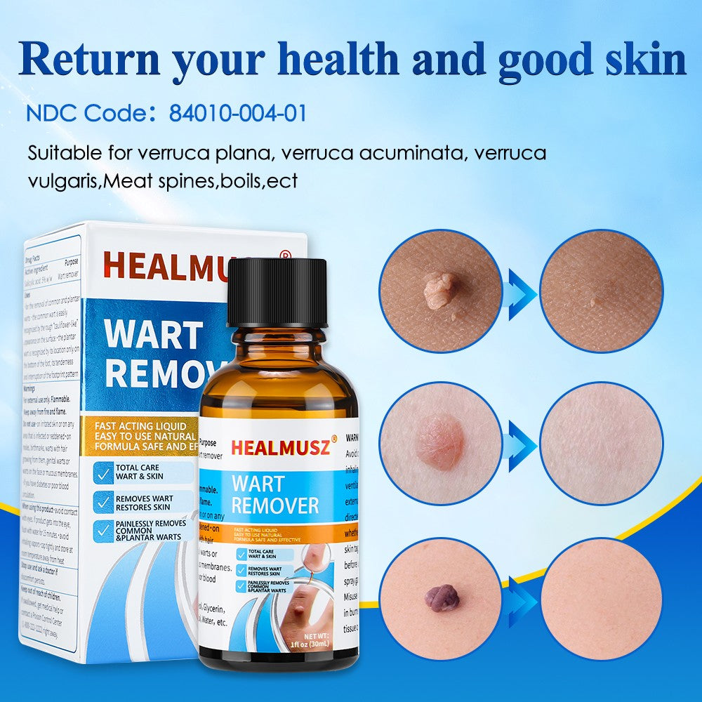 Natural Wart & Skin Tag Remover Liquid - Deep Penetration Formula, 30ml