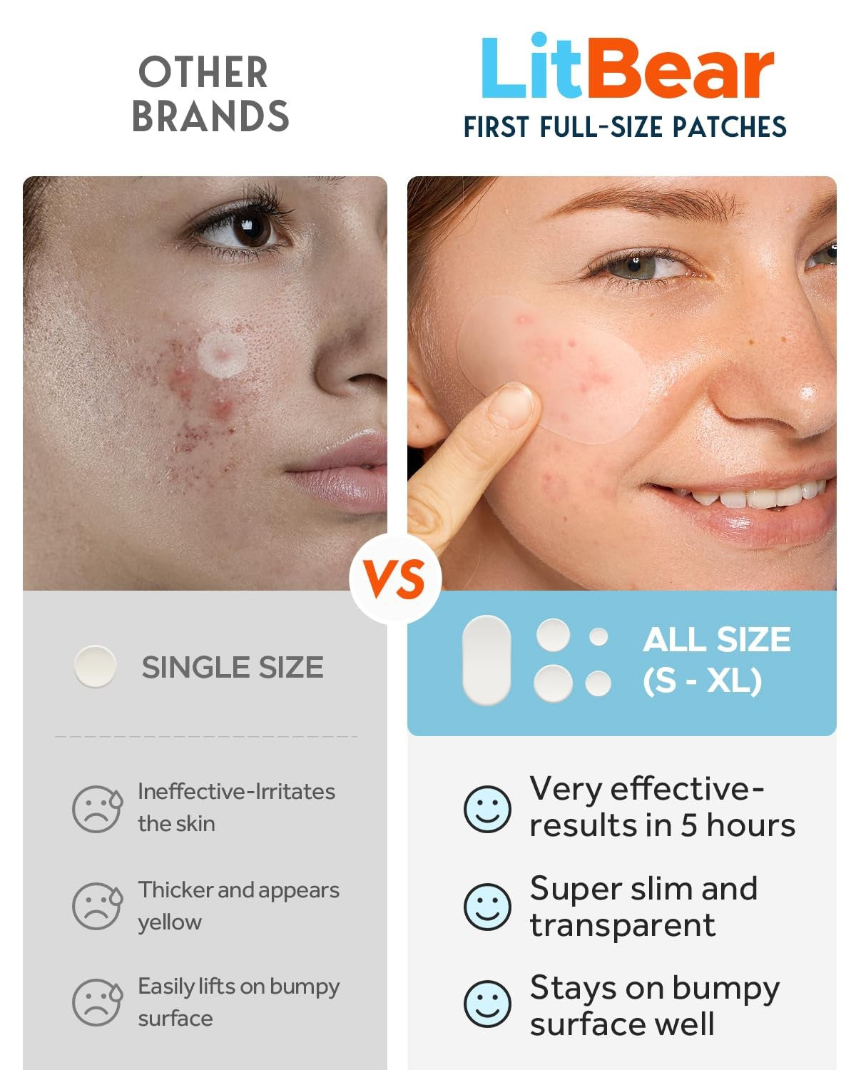 Large Acne Pimple Patches - 5 Sizes, 80 Count, Transparent