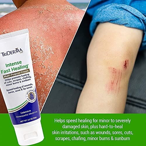 Fast Healing Cream for Face & Body – 2.2 oz Tube