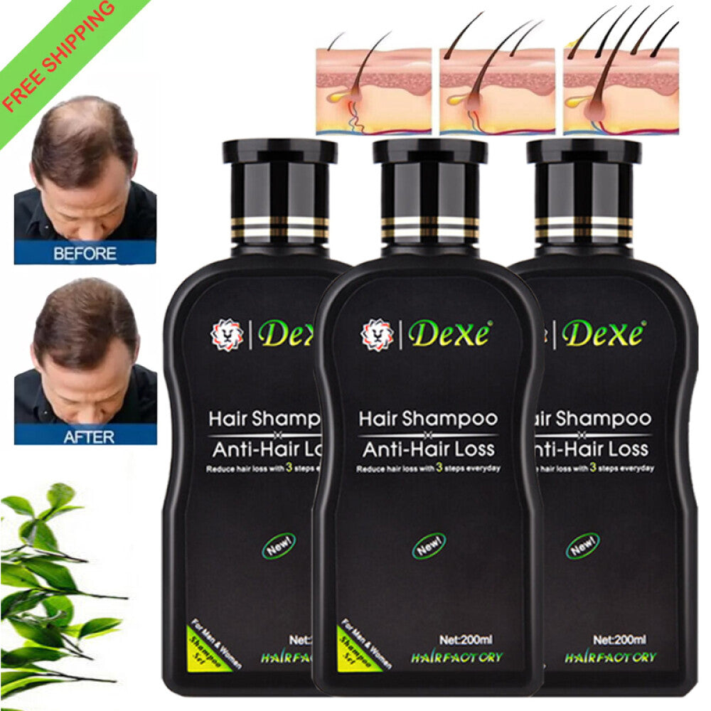 Anti Hair Loss Shampoo for Women & Men – Herbal Hair Growth Treatment