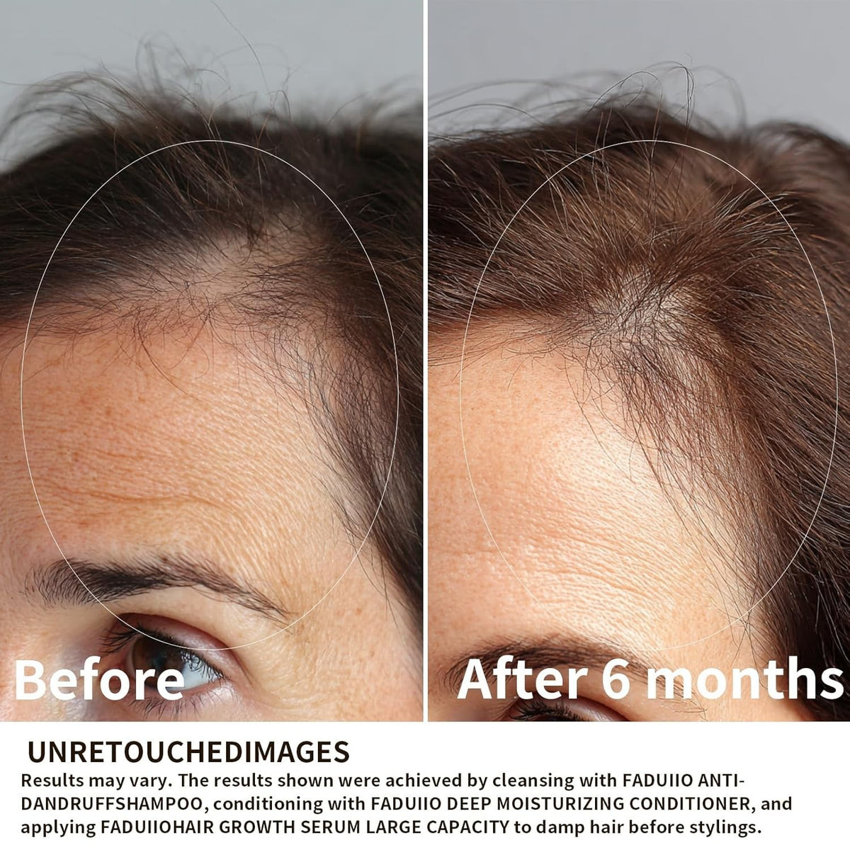 Hair Growth Serum with Biotin, Peptides & Caffeine - 2 oz