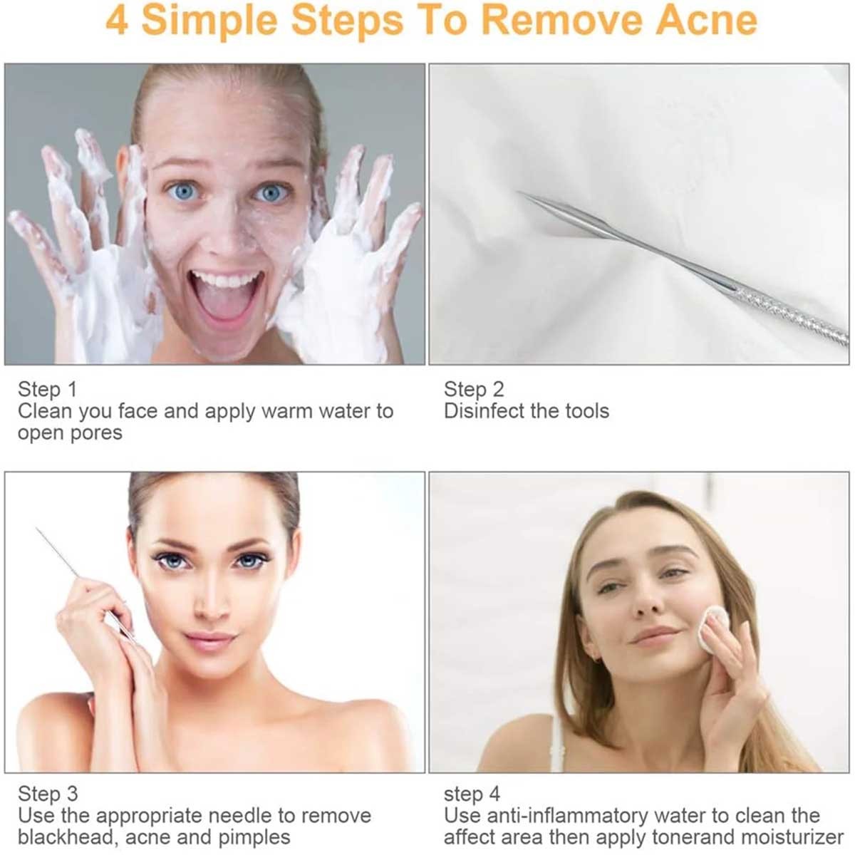 9-Piece Blackhead Remover Tool Kit for Comedone Extraction - Stainless Steel