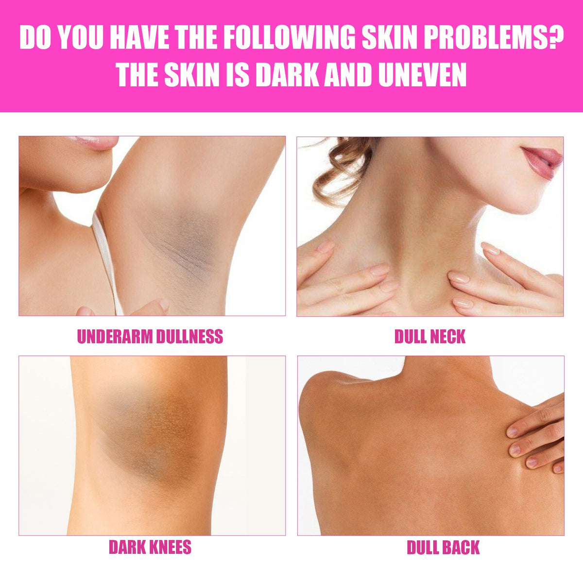 Dark Skin Brightening Cream for Full Body & Face - Lightening & Whitening