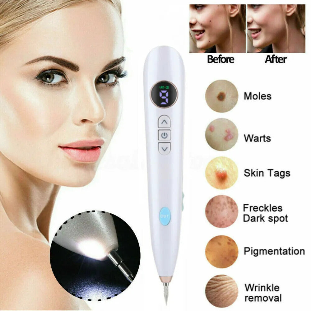 Electric Laser Plasma Mole & Skin Tag Removal Pen - Dark Spot Tattoo Remover