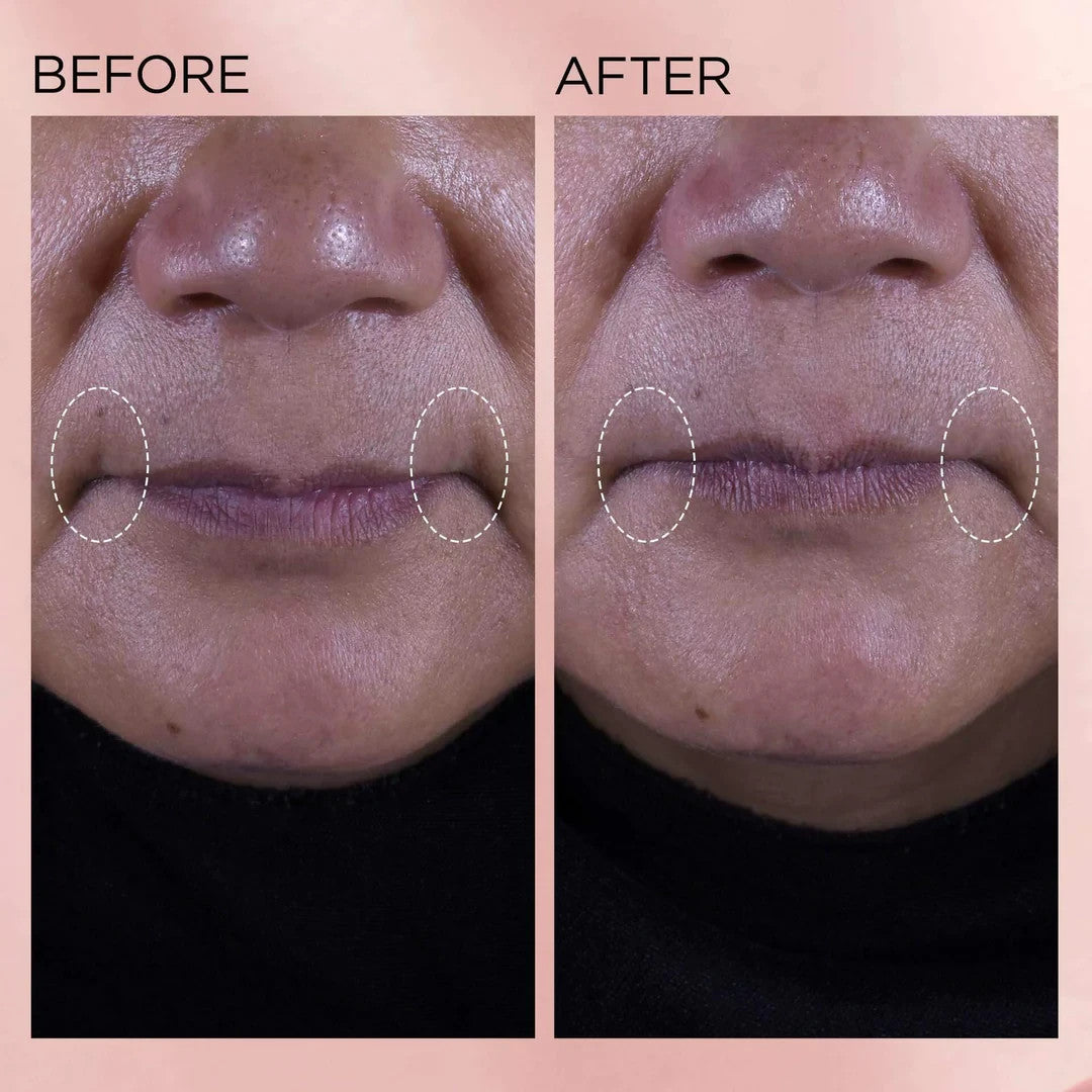 Retinol Ceramide Face Moisturizer - Anti-Aging Water Cream 50ml