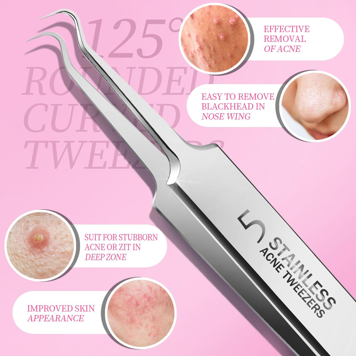 Blackhead Remover Pimple Extractor Tool Kit with 2 Silver Tools