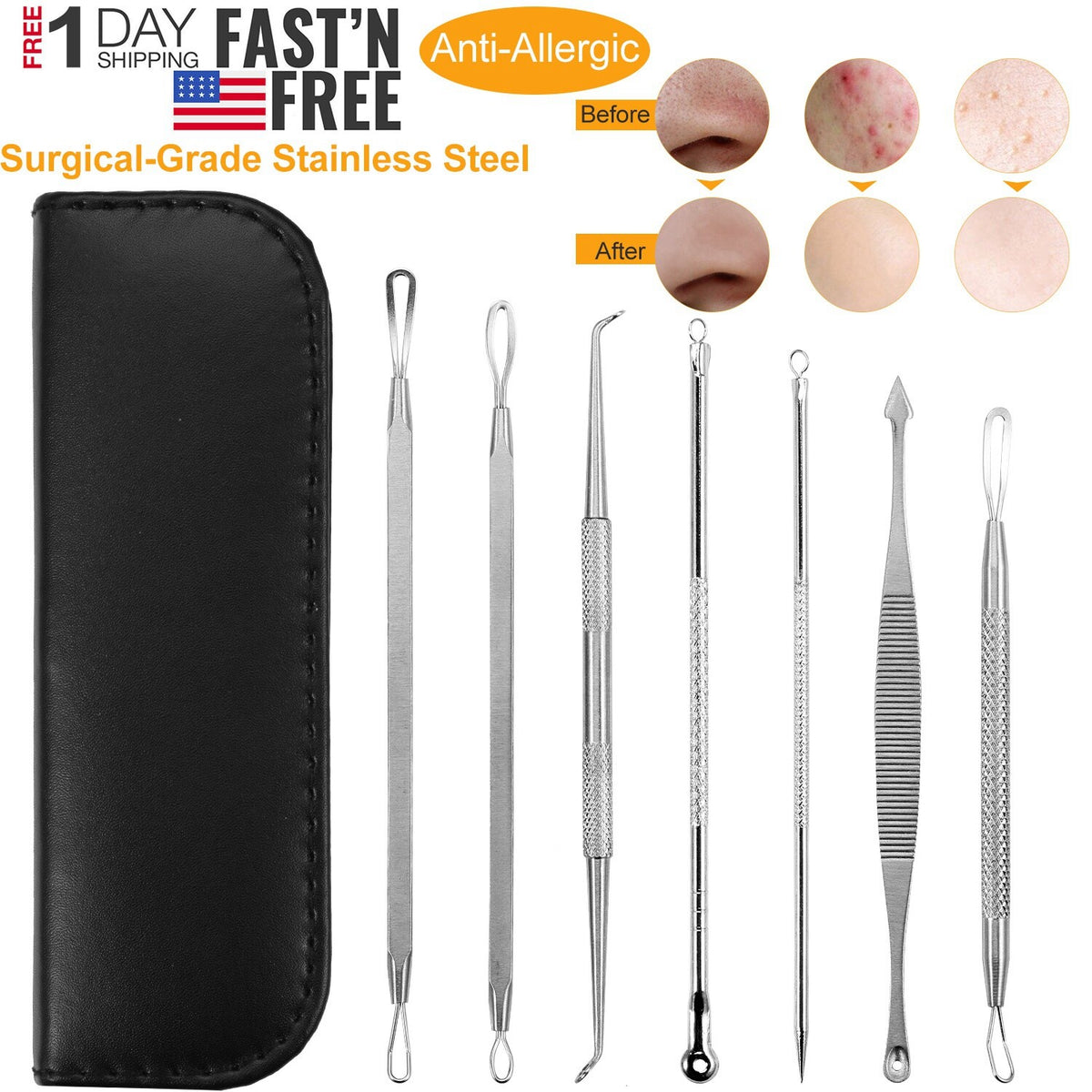7PC Blackhead and Acne Comedone Extractor Kit - Stainless Steel Facial Blemish Removers
