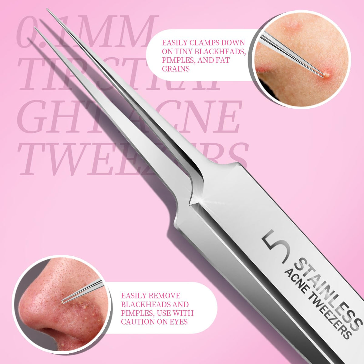 Blackhead Remover Pimple Extractor Tool Kit with 2 Silver Tools
