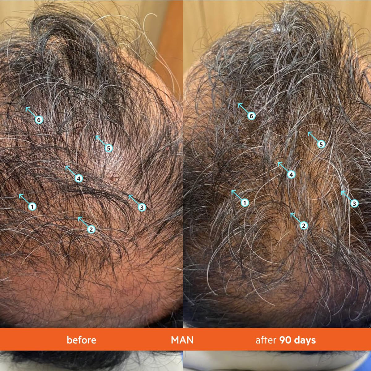 Revita Hair Density Shampoo for Thinning Hair, color safe, 205 mL,